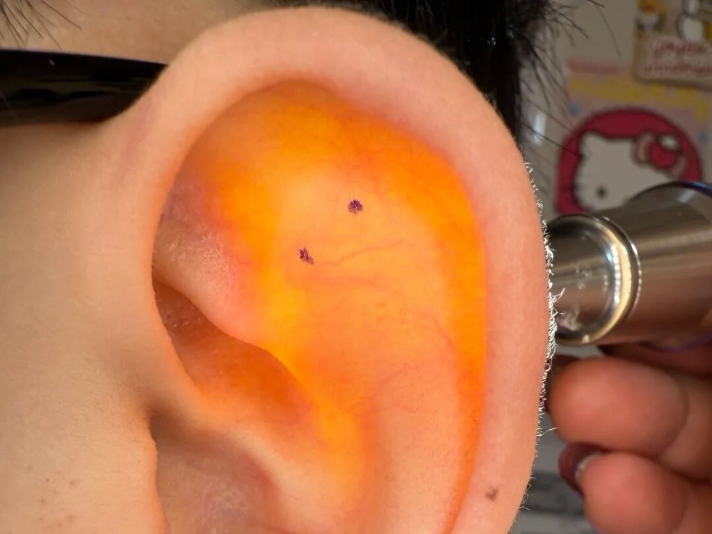 How Should a Helix Piercing Be Done marking helix piercing placement