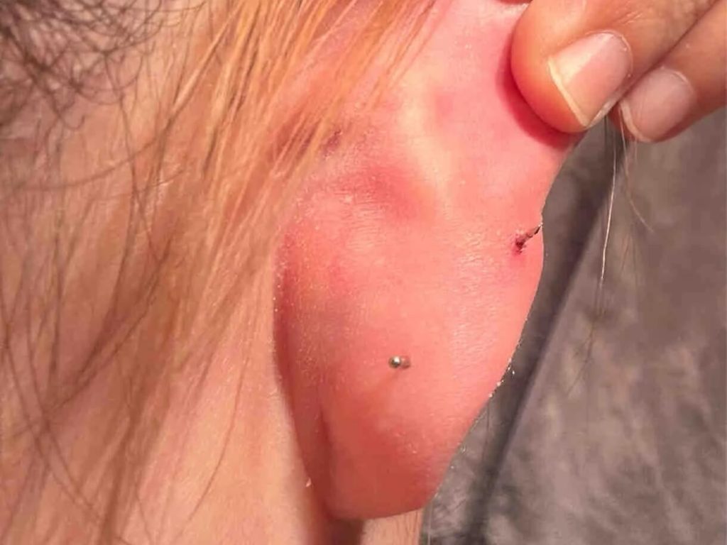 where is a mid helix piercing see from the back